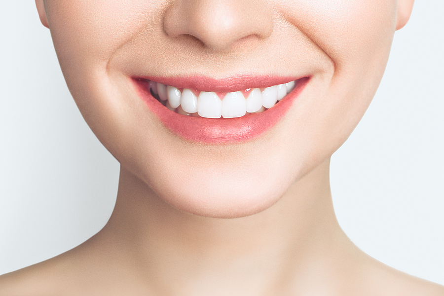 Achieve a Perfect Smile with SureSmile: Your Guide to SureSmile in St. Louis, MO